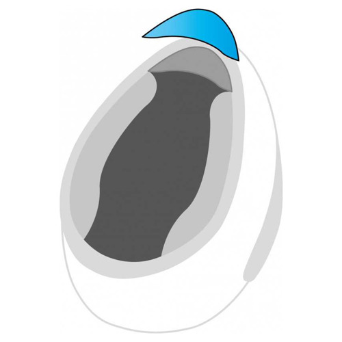 Chin Curtain IS-Max II